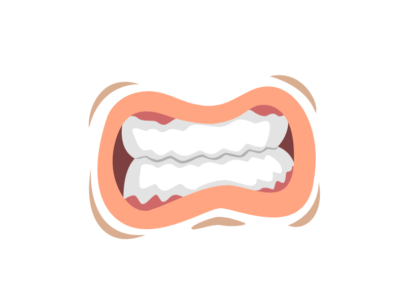 噛み合わせの問題