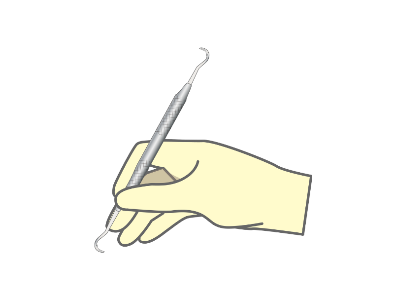 ハンドスケーラー