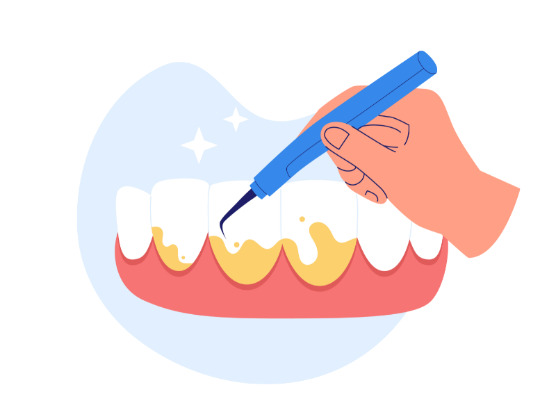 SC（スケーリング）