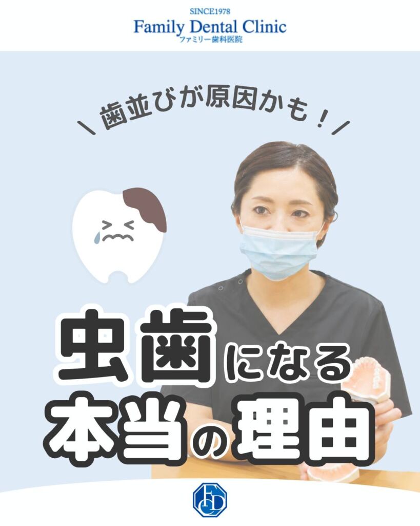 こんばんは！ファミリー歯科医院です🦷✨ 今回は、虫歯リスクと予防方法についてご紹…