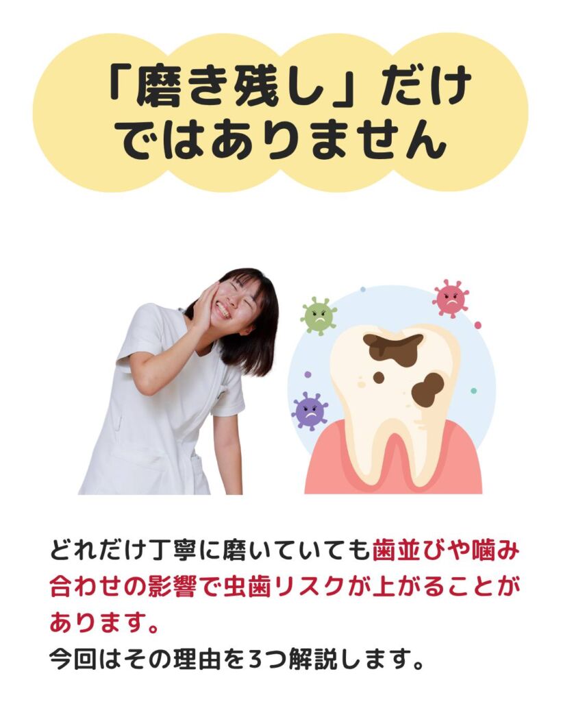 今回は、虫歯リスクと予防方法についてご紹介します🙌