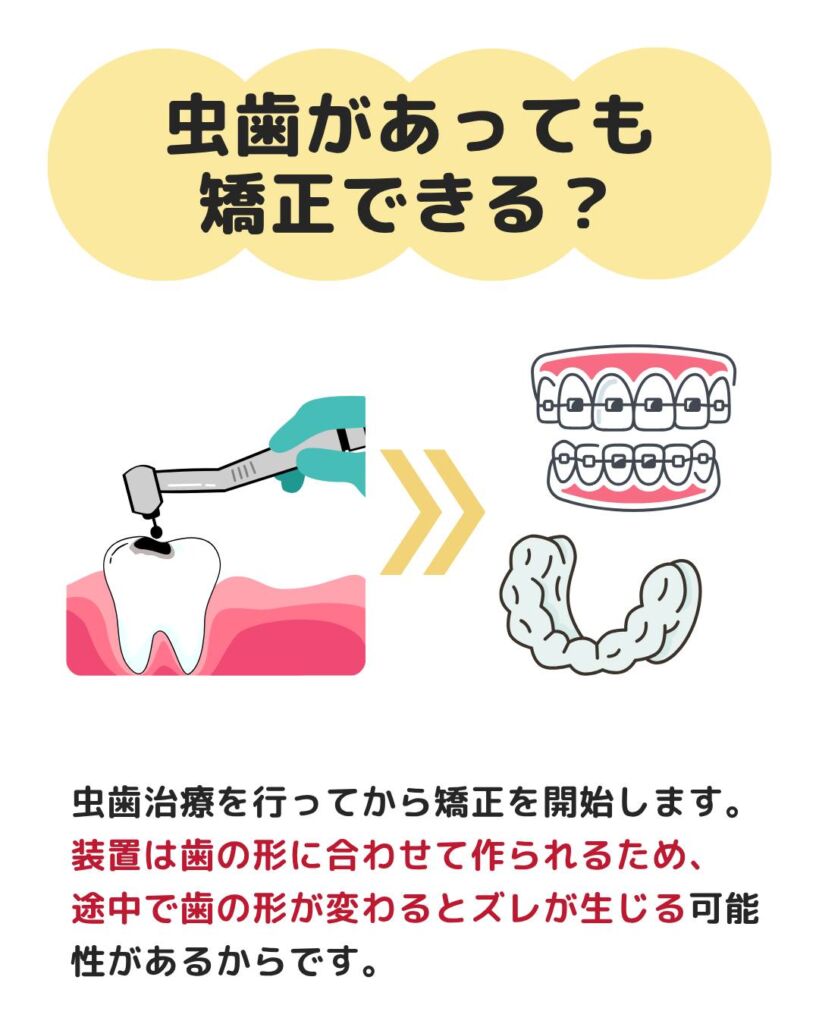 今回は、虫歯リスクと予防方法についてご紹介します🙌