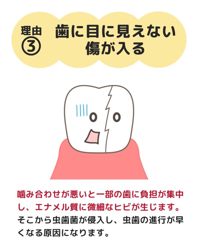 今回は、虫歯リスクと予防方法についてご紹介します🙌