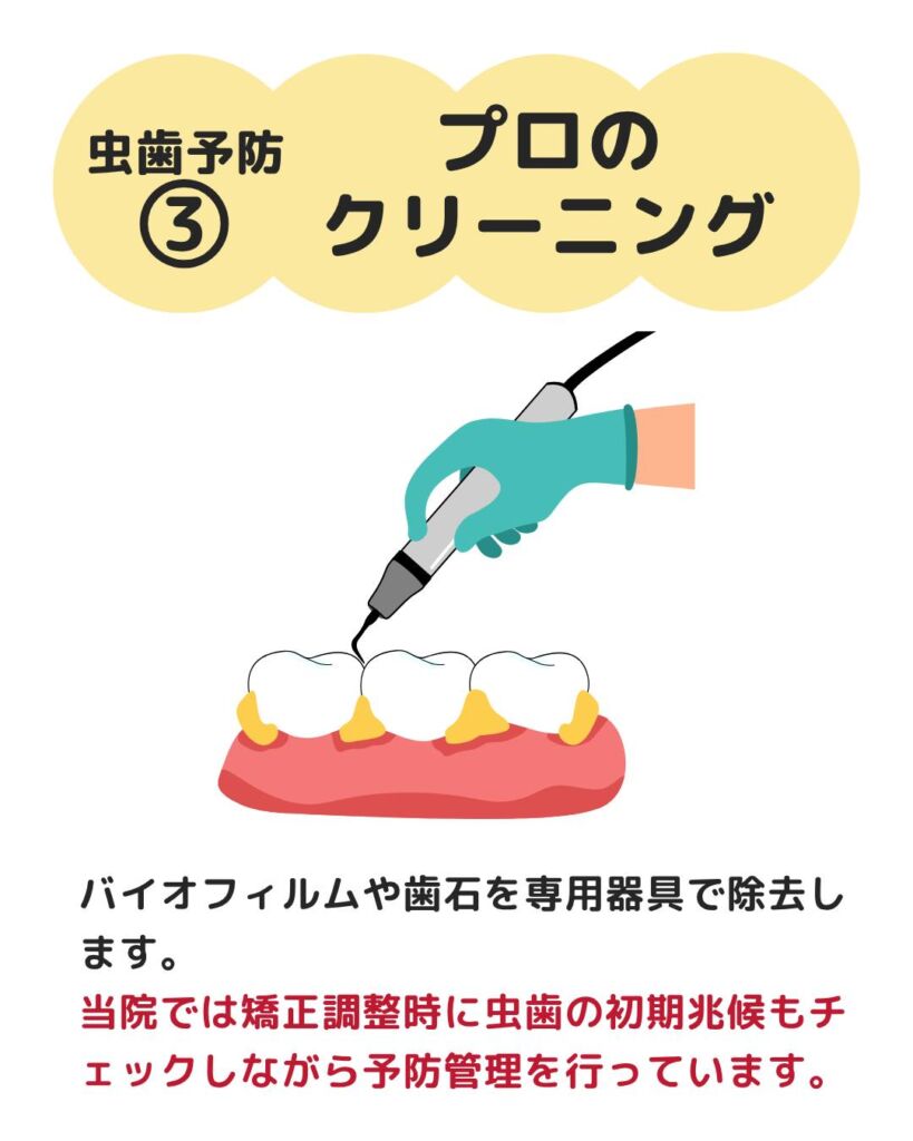 今回は、虫歯リスクと予防方法についてご紹介します🙌