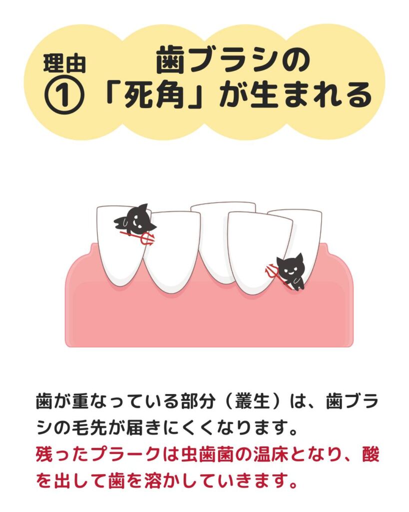 今回は、虫歯リスクと予防方法についてご紹介します🙌