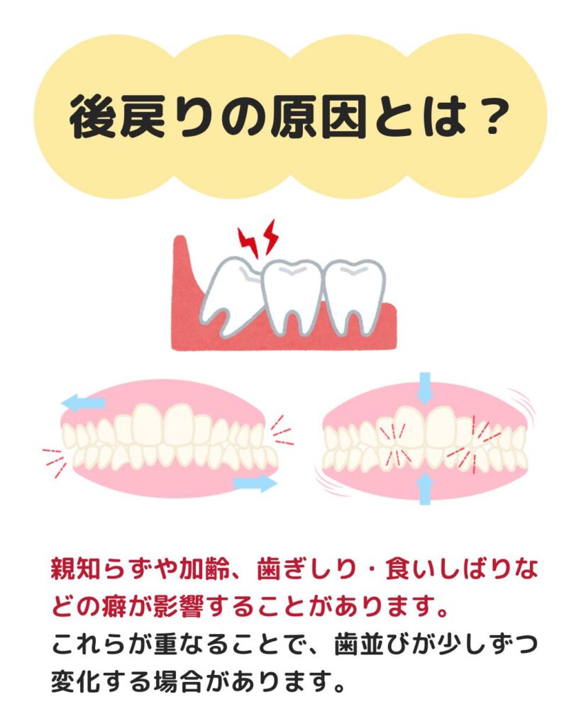 矯正治療によって整えた歯並びが、時間の経過とともに変化してきたと感じることはありませんか?