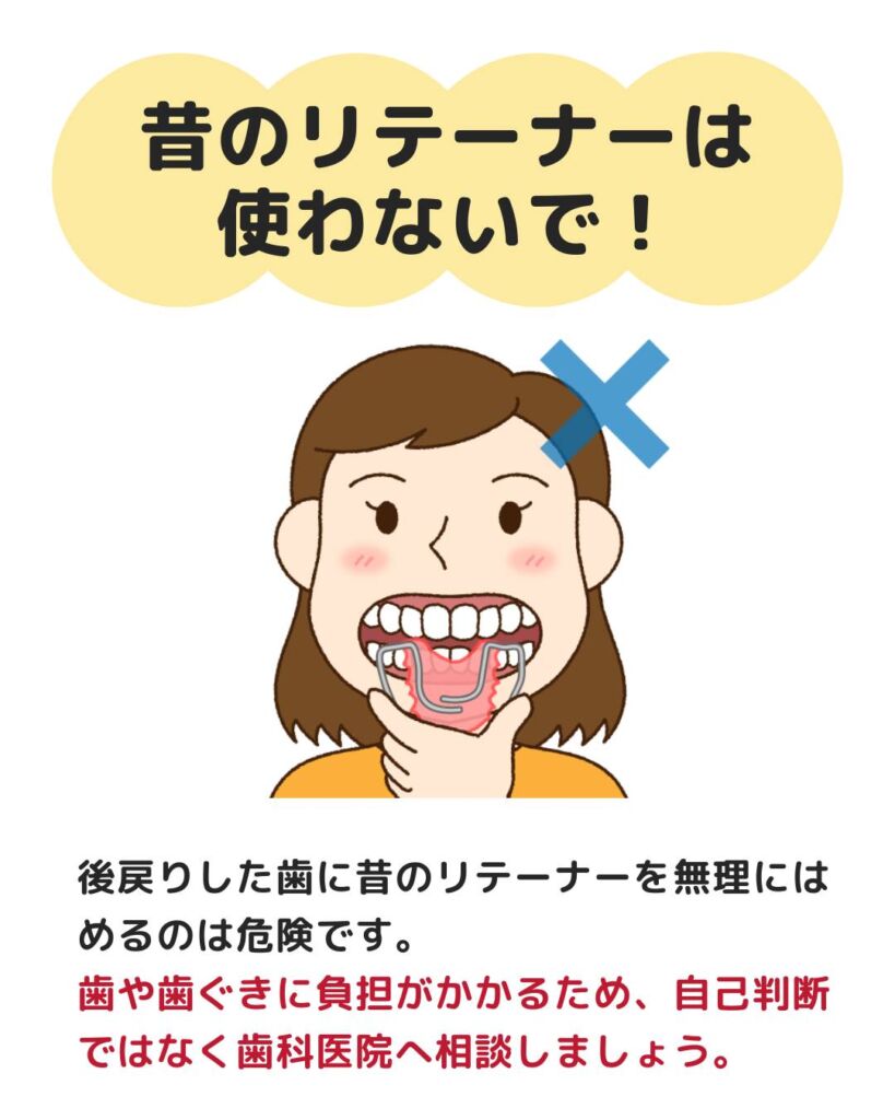 矯正治療によって整えた歯並びが、時間の経過とともに変化してきたと感じることはありませんか?