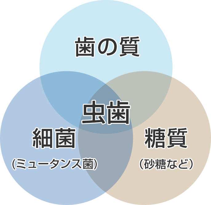 虫歯の原因解説図