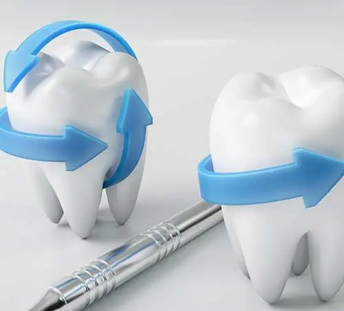 歯の色・形が気になる