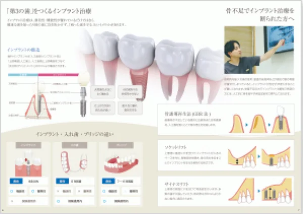インプラント治療の基本を解説した資料の誌面