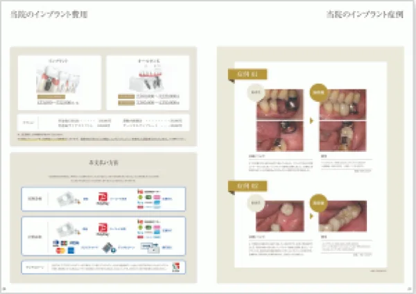 費用・治療期間を解説した資料の誌面